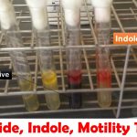 Sulfide, Indole, Motility Test: Principle, Procedure, Result Interpretation and Limitations