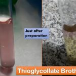 Thioglycollate Broth: Introduction, Composition, Preparation, Principle and Interpretation, Uses and Keynotes