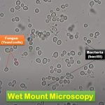Wet Mount Microscopy: Introduction, Principle, Preparation, Result Interpretation, Limitations and Related Videos