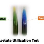 Acetate Utilization Test: Introduction, Principle, Test Requirements, Test Procedure, Result and Interpretation and Keynotes
