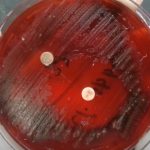 Anaerobes Presumptive Identification using Antibiotic disks: Introduction, Principle, Procedure, Result Interpretation and Keynotes