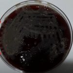 Bacillus species: Introduction, Classification and Medically Important species, Pathogenecity, Lab Diagnosis and Treatment