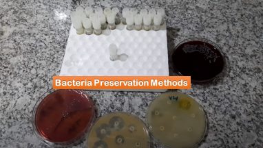 Bacteria Preservation: Introduction, Storage methods, Common Procedure for Preservation of Bacteria and Keynotes