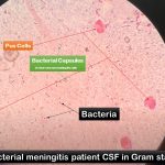 Bacterial Capsule Demonstration Using Negative Staining Method: Introduction, Principle, Procedure, Result Interpretation and Keynotes