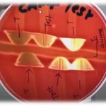 CAMP Reaction: Introduction, Principle, Test Requirements, Test Procedure, Result and Interpretation and Keynotes