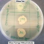 Deoxyribonuclease Test: Introduction, Principle, Test Requirements, Test Procedure, Result and Interpretation and Keynotes