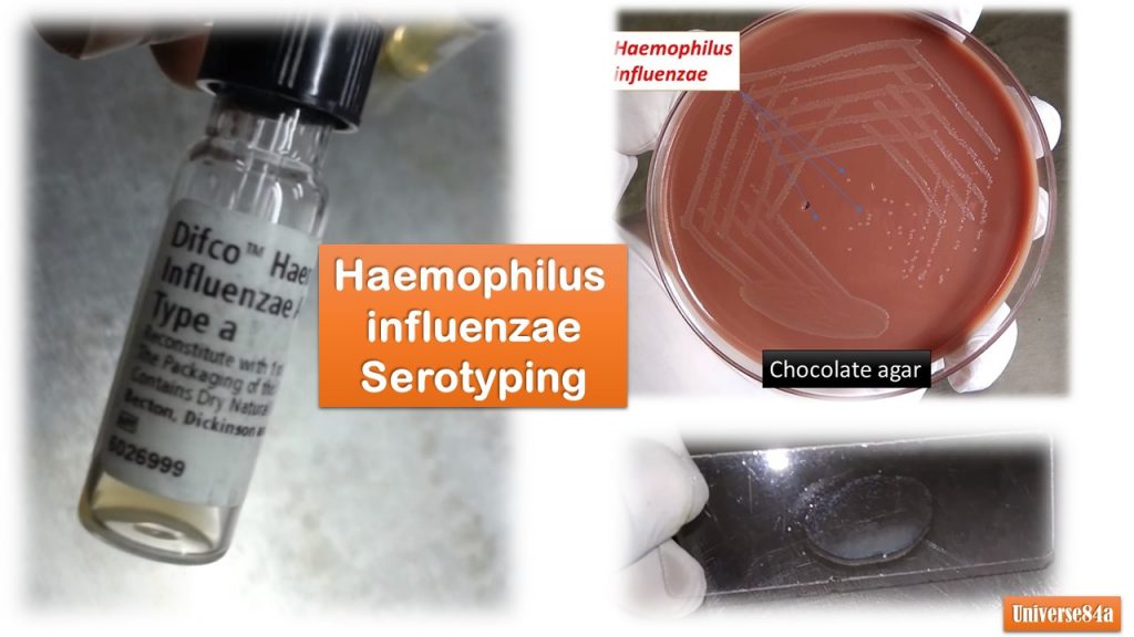 Haemophilus Serotyping: Introduction, Principle, Requirements, Test Procedure, Result Interpretation and Keynotes