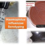 Haemophilus Serotyping: Introduction, Principle, Requirements, Test Procedure, Result Interpretation and Keynotes