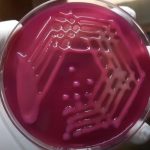 K pneumoniae: Introduction, Classification, Pathogenicity, Laboratory Diagnosis and Treatment