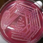 Klebsiella pneumoniae: Introduction, Classification, Pathogenicity, Laboratory Diagnosis and Treatment