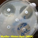 MHA: Introduction, Composition, Principle, Preparation, Modifications, Application, Limitations and Keynotes