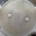 Novobiocin Susceptibility Test: Introduction, Principle, Procedure, Result Interpretation and Keynotes