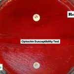 Optochin Sensitivity Test: Introduction, Principle, Test Requirements, Test Procedure, Result and Interpretation and Keynotes