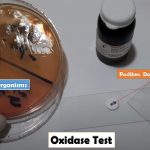 Oxidase Test: Introduction, Principle, Test Requirements, Procedure, Result Interpretation and Keynotes