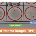 Rapid Plasma Reagin (RPR) Test: Introduction, Principle, Procedure, Result Interpretation and Limitations