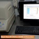 Real-Time RT-PCR in COVID-19 Detection: Introduction, Principle, Procedure and Result Interpretation
