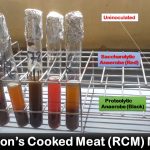 Robertson’s Cooked Meat (RCM) Medium: Introduction, Principle, Composition, Preparation, Test Procedure, Result Interpretation, Uses and Keynotes