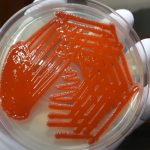 S. marcescens: Introduction, Classification, Pathogenecityl, Lab Diagnosis, Treatment, Prevention and Keynotes