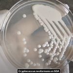SDA: Introduction, Principle, Composition, Preparation, Colony Characteristics and Uses