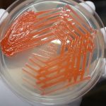 Serratia: Introduction, Classification, Pathogenecityl, Lab Diagnosis, Treatment, Prevention and Keynotes