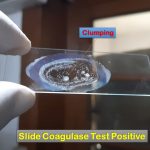 Slide Coagulase Test: Introduction, Principle, Procedure, Result Interpretation, Limitations and Keynotes