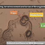 Strongyloidiasis: Introduction,Life cycle of Strongyloides, Morphology,Symptoms, Lab Diagnosis and Treatment