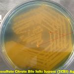 TCBS Agar: Introduction, Composition, Uses of Ingredients, Test Procedure, Result Interpretation and Limitation
