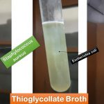 Thioglycollate Medium- Introduction, Composition, Preparation, Principle, Test Procedure, Result Interpretation, Uses and Keynotes-