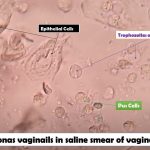 Trichomonas vaginails saline smear: Introduction, Principle, Test Requirements, Test Procedure, Result and Interpretation and Keynotes