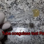 Tube Coagulase Test: Introduction, Principle, Procedure, Result Interpretation,Limitations and Keynotes