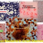 Various Bacteria Gram Stain: Introduction, List of Bacteria, Short Description with Visual Demonstration and Keynotes