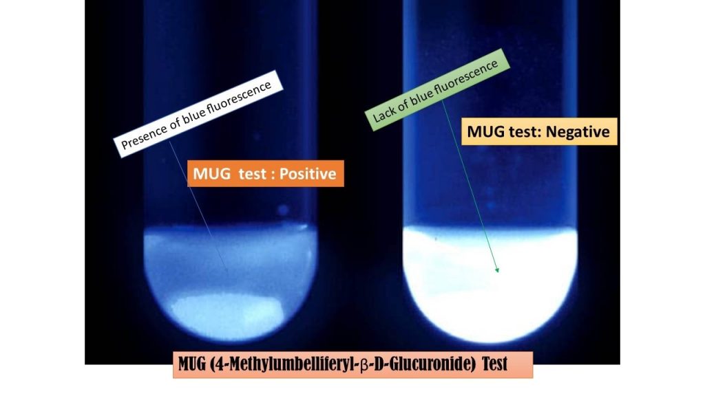 4-Methylumbelliferyl-β-D Glucuronide Test: Introduction, Principle, Procedure, Result Interpretation, Uses and Keynotes
