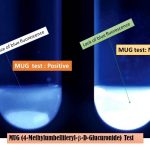 4-Methylumbelliferyl-β-D Glucuronide Test: Introduction, Principle, Procedure, Result Interpretation, Uses and Keynotes