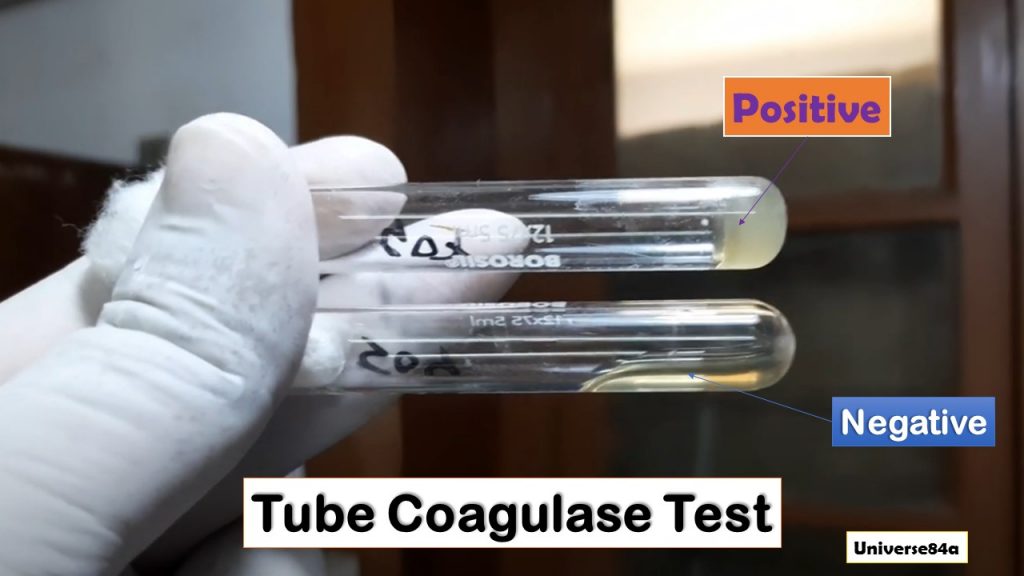 Bacterial Coagulase Test: Introduction, Principle, Procedure, Result Interpretation, Limitations and Keynotes