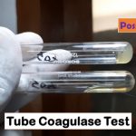 Bacterial Coagulase Test: Introduction, Principle, Procedure, Result Interpretation, Limitations and Keynotes