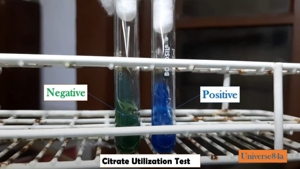 Citrate Utilization Test: Introduction, Principle, Procedure, Result and Interpretation, Citrate Utilization Test Positive Bacteria and keynotes