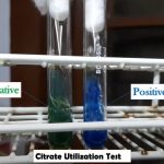Citrate Utilization Test: Introduction, Principle, Procedure, Result and Interpretation, Citrate Utilization Test Positive Bacteria and keynotes