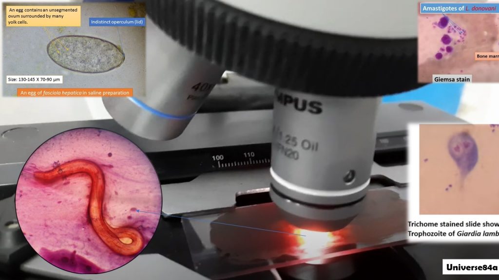 Common Medical Parasites: Introduction, List of Parasites, Text Links and Visual Links