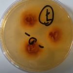 DTM: Introduction, Principle, Composition, Test Procedure, Colony Characteristics and Uses