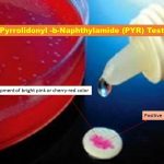 L-pyrrolidinyl-β-naphthylamide Test: Introduction, Principle, Procedure, Result Interpretation, Uses and Keynotes