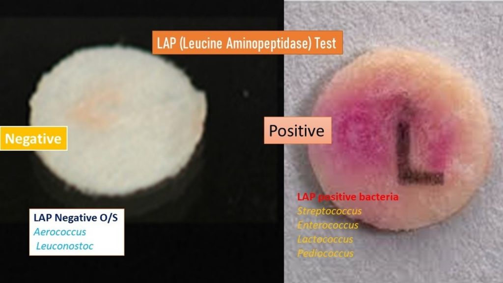 Leucine Aminopeptidase (LAP) Test: Introduction, Principle, Procedure, Result Interpretation and Limitations