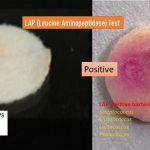Leucine Aminopeptidase (LAP) Test: Introduction, Principle, Procedure, Result Interpretation and Limitations