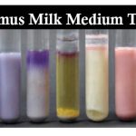 Litmus Milk Test: Introduction, Principle, Composition, Preparation, Procedure, Result Interprettation, Uses and Keynotes