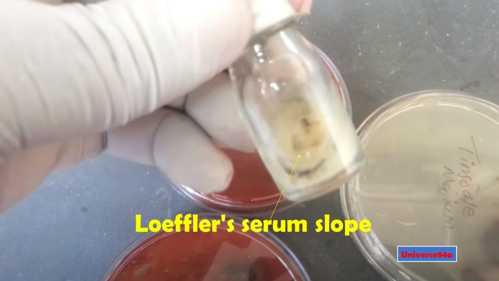 Loeffler Serum Slope: Introduction, Principle, Composition, Preparation, Procedure, Colony Morphology, Uses and Keynotes