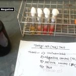 MR Test: Introduction, Principle, Procedure, Result Interpretation and Keynotes