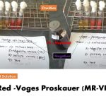 MR-VP Test: Introduction, Principle, Procedure, Result Interpretation and Keynotes