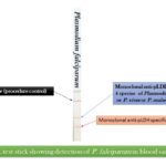 OptiMAL-Test-for-Malaria-Parasites-Introduction-Principle-Procedure-Result-Interpretation-Clinical-Significance-and-Keynotes