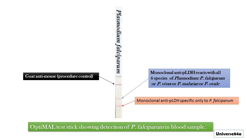 OptiMAL Test for Rapid Diagnosis of Malarial Parasites: Introduction, Principle, Procedure, Result Interpretation, Clinical Significance and Keynotes