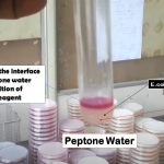 Peptone Water: Introduction, Principle, Composition, Preparation, Procedure, Colony Morphology, Uses and Keynotes