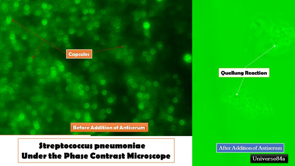 Quellung Reaction: Introduction, Principle, Procedure, Result Interpretation, Uses and Keynotes
